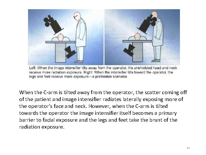 When the C-arm is tilted away from the operator, the scatter coming off of