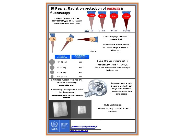 10 Pearls: Radiation protection of patients in fluoroscopy 6. Larger patients or thicker body