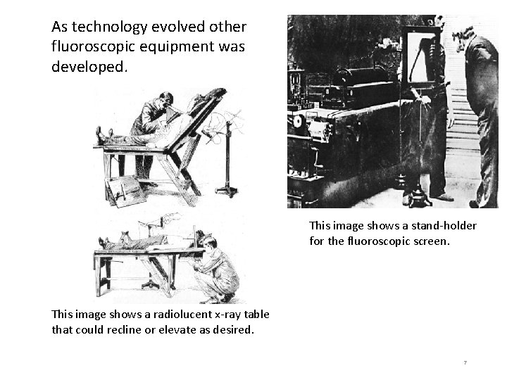 As technology evolved other fluoroscopic equipment was developed. This image shows a stand-holder for