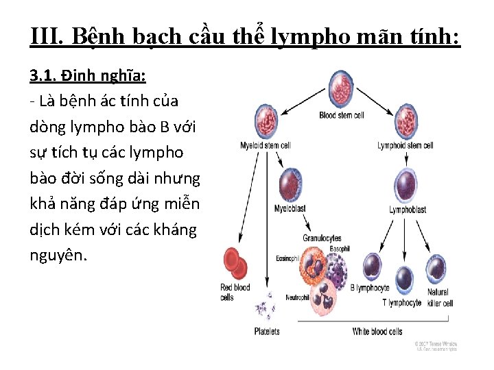 III. Bệnh bạch cầu thể lympho mãn tính: 3. 1. Định nghĩa: - Là