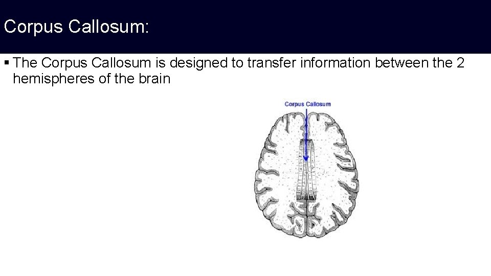 Corpus Callosum: § The Corpus Callosum is designed to transfer information between the 2