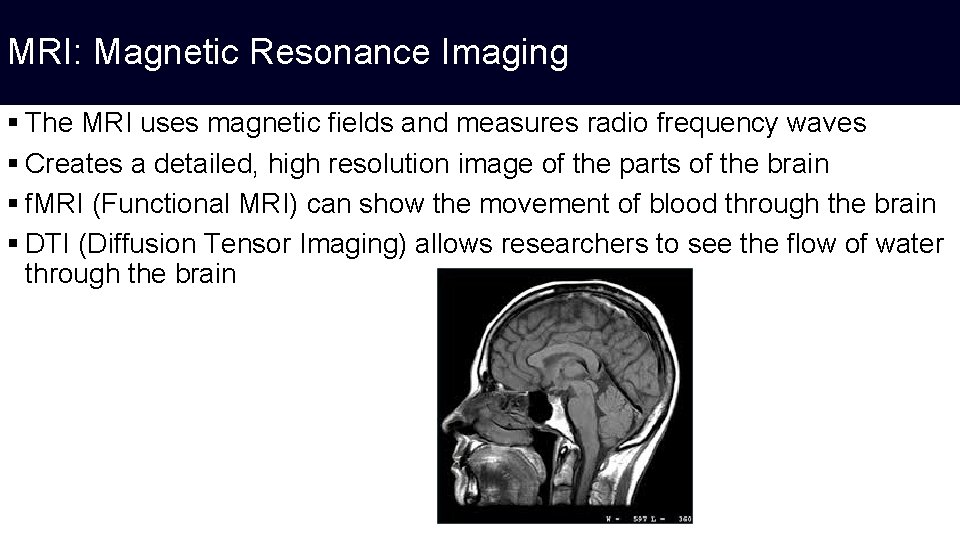 MRI: Magnetic Resonance Imaging § The MRI uses magnetic fields and measures radio frequency