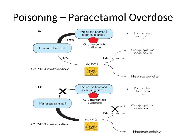 Poisoning – Paracetamol Overdose 