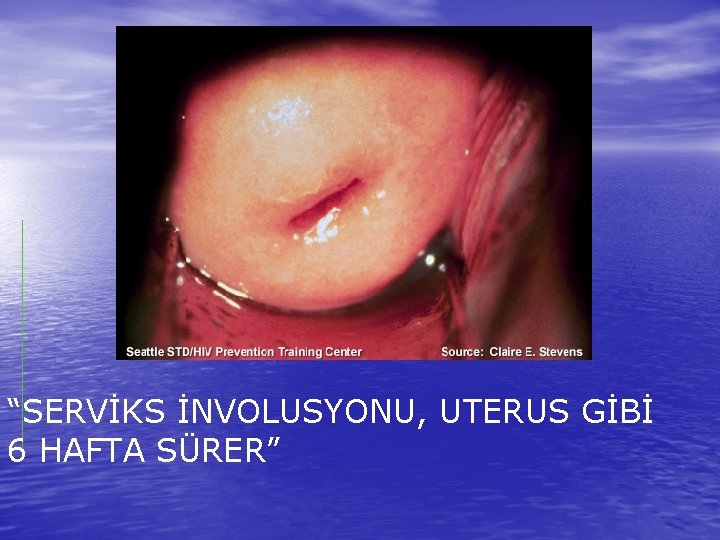 “SERVİKS İNVOLUSYONU, UTERUS GİBİ 6 HAFTA SÜRER” 