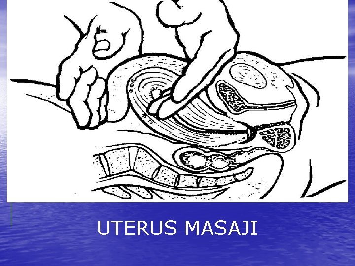 UTERUS MASAJI 