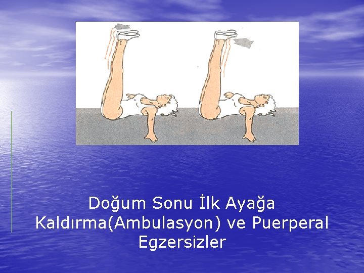 Doğum Sonu İlk Ayağa Kaldırma(Ambulasyon) ve Puerperal Egzersizler 