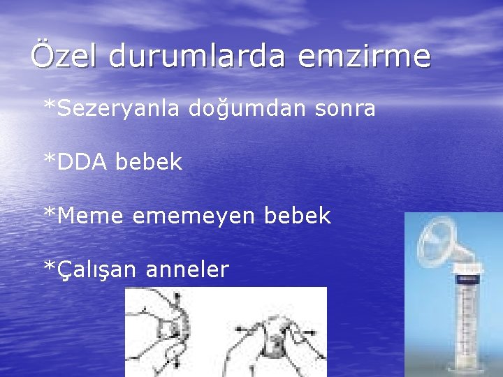 Özel durumlarda emzirme *Sezeryanla doğumdan sonra *DDA bebek *Meme ememeyen bebek *Çalışan anneler 