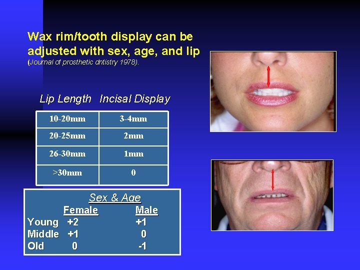 Wax rim/tooth display can be adjusted with sex, age, and lip (Journal of prosthetic Wax rim/tooth display can be adjusted with sex, age, and lip (Journal of prosthetic