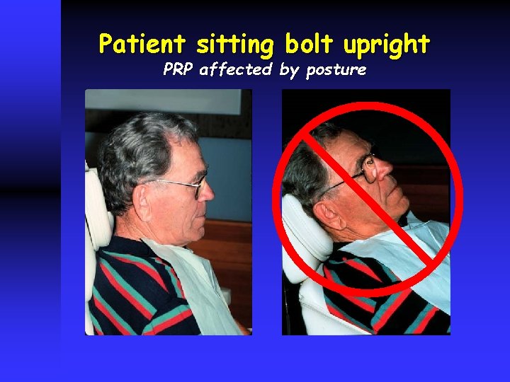 Patient sitting bolt upright PRP affected by posture Patient sitting bolt upright PRP affected by posture
