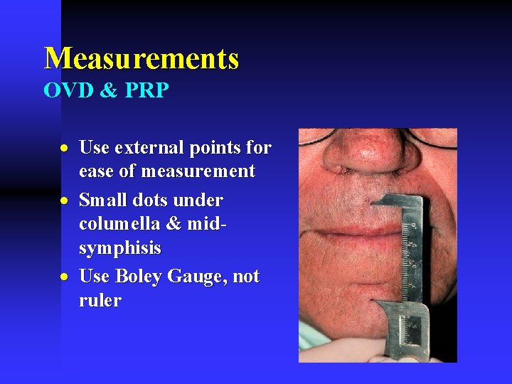 Measurements OVD & PRP · Use external points for ease of measurement · Small Measurements OVD & PRP · Use external points for ease of measurement · Small