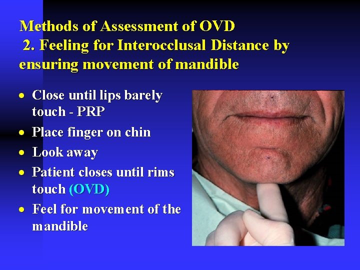 Methods of Assessment of OVD 2. Feeling for Interocclusal Distance by ensuring movement of Methods of Assessment of OVD 2. Feeling for Interocclusal Distance by ensuring movement of