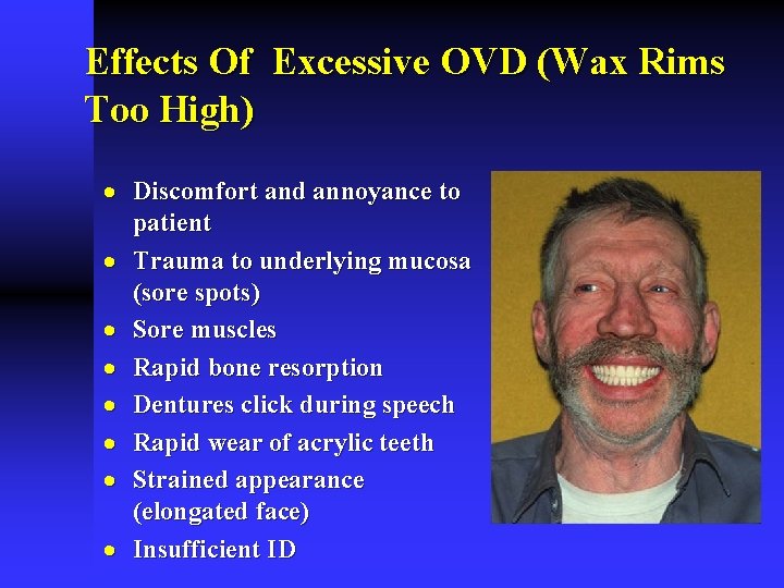 Effects Of Excessive OVD (Wax Rims Too High) · Discomfort and annoyance to patient Effects Of Excessive OVD (Wax Rims Too High) · Discomfort and annoyance to patient