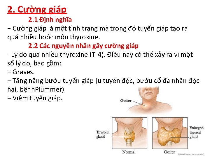 2. Cường giáp 2. 1 Định nghĩa − Cường giáp là một tình trạng