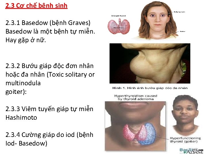 2. 3 Cơ chế bệnh sinh 2. 3. 1 Basedow (bệnh Graves) Basedow là