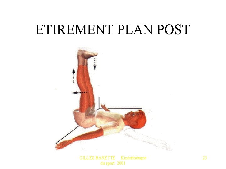 ETIREMENT PLAN POST GILLES BARETTE Kinésithérapie du sport 2001 23 