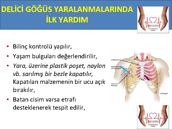 DELİCİ GÖĞÜS YARALANMALARINDA İLK YARDIM • Bilinç kontrolü yapılır, • Yaşam bulguları değerlendirilir, •