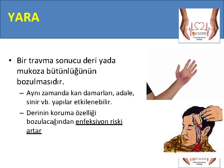YARA • Bir travma sonucu deri yada mukoza bütünlüğünün bozulmasıdır. – Aynı zamanda kan