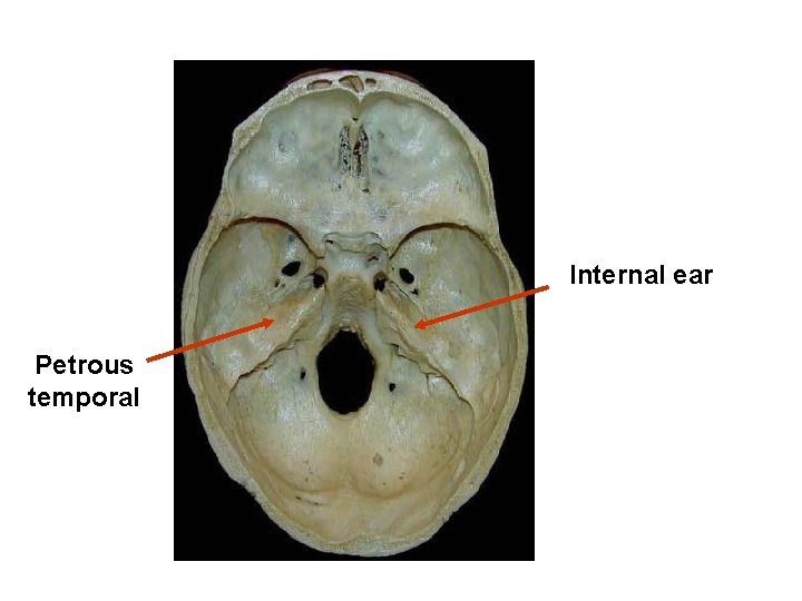 Internal ear Petrous temporal 