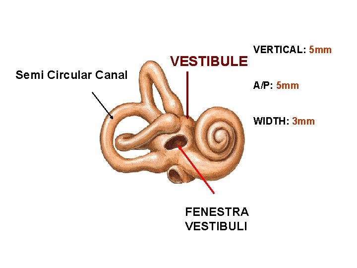 Semi Circular Canal VESTIBULE VERTICAL: 5 mm SPHERICAL RECESS A/P: 5 mm WIDTH: 3