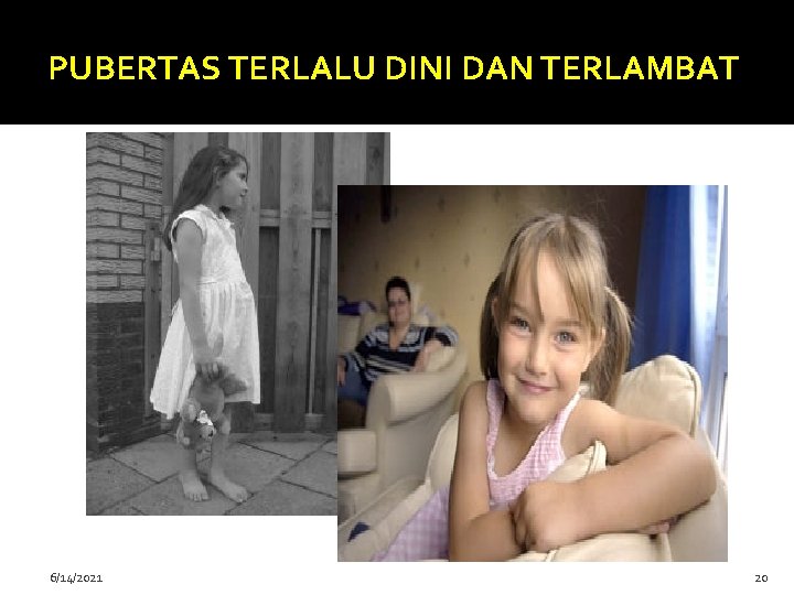 PUBERTAS TERLALU DINI DAN TERLAMBAT 6/14/2021 20 