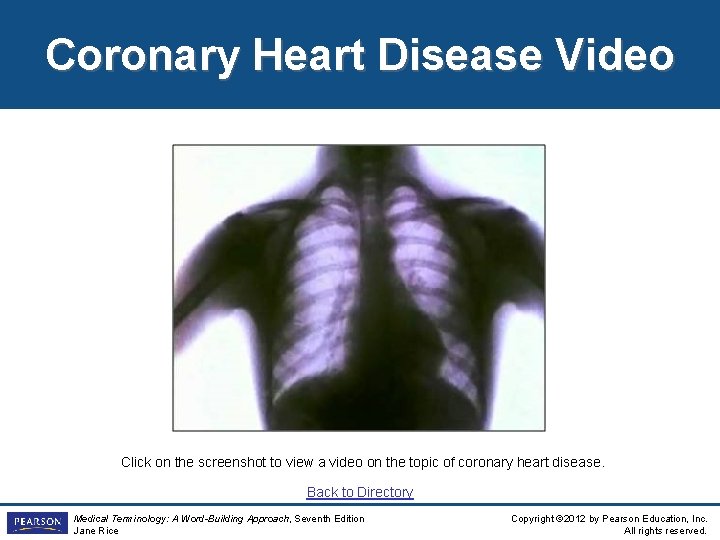 Coronary Heart Disease Video Click on the screenshot to view a video on the
