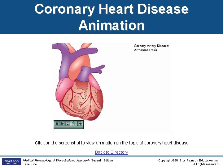 Coronary Heart Disease Animation Click on the screenshot to view animation on the topic