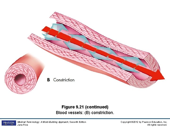 Figure 9. 21 (continued) Blood vessels: (B) constriction. Medical Terminology: A Word-Building Approach, Seventh
