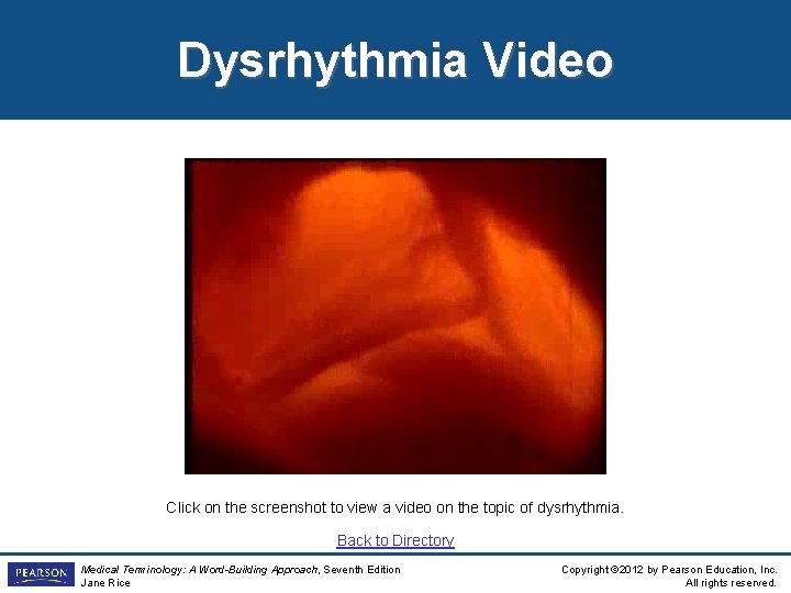 Dysrhythmia Video Click on the screenshot to view a video on the topic of