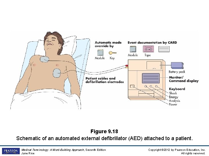 Figure 9. 18 Schematic of an automated external defibrillator (AED) attached to a patient.