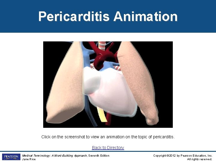 Pericarditis Animation Click on the screenshot to view an animation on the topic of