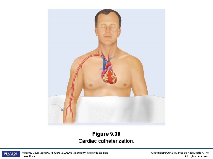 Figure 9. 38 Cardiac catheterization. Medical Terminology: A Word-Building Approach, Seventh Edition Jane Rice