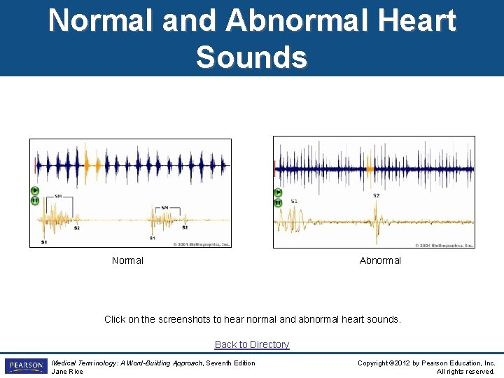 Normal and Abnormal Heart Sounds Normal Abnormal Click on the screenshots to hear normal