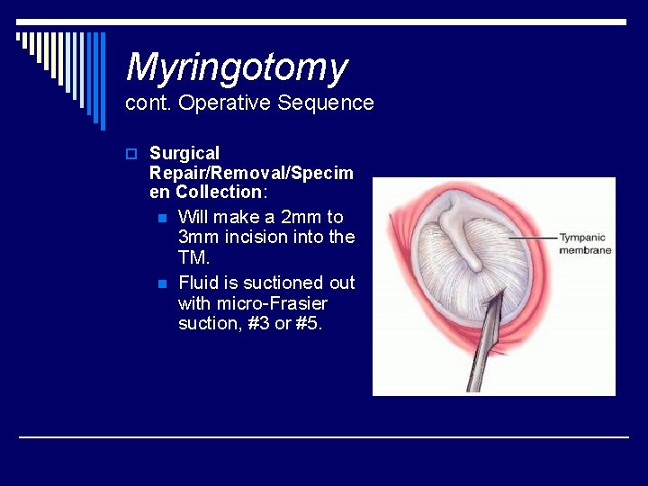 Myringotomy cont. Operative Sequence o Surgical Repair/Removal/Specim en Collection: n n Will make a