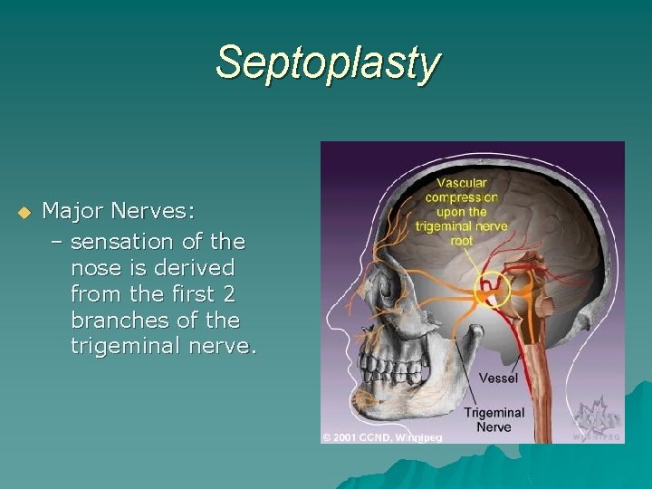 Septoplasty u Major Nerves: – sensation of the nose is derived from the first