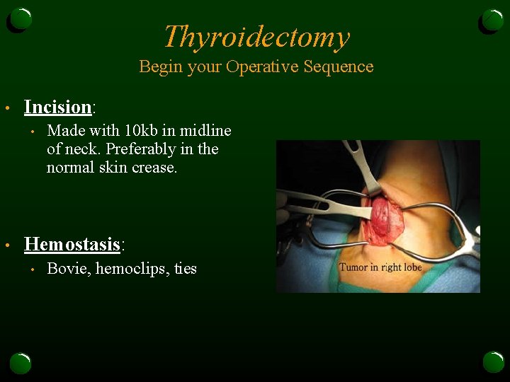 Thyroidectomy Begin your Operative Sequence • Incision: • • Made with 10 kb in