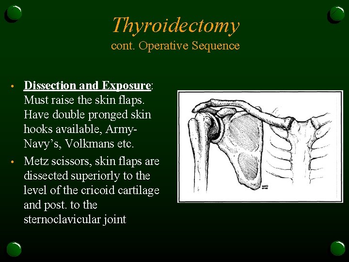 Thyroidectomy cont. Operative Sequence • • Dissection and Exposure: Must raise the skin flaps.