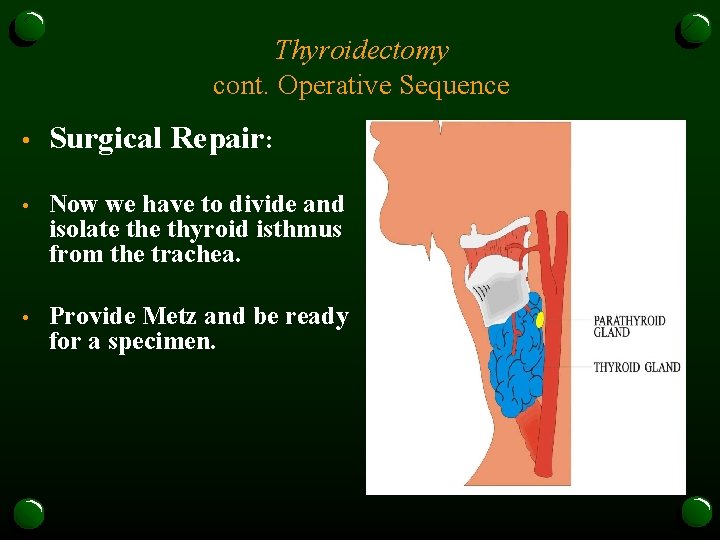 Thyroidectomy cont. Operative Sequence • Surgical Repair: • Now we have to divide and