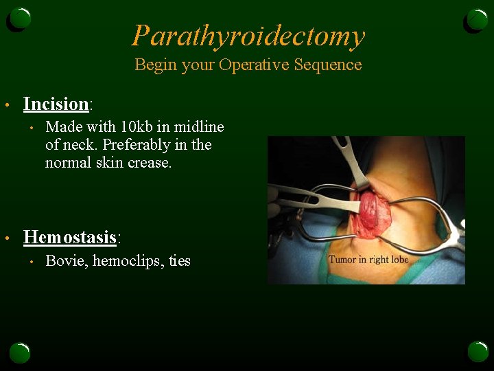 Parathyroidectomy Begin your Operative Sequence • Incision: • • Made with 10 kb in