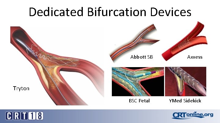 Dedicated Bifurcation Devices Abbott SB Axxess Tryton BSC Petal YMed Sidekick 