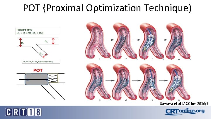 POT (Proximal Optimization Technique) Sawaya et al JACC Inv 2016; 9 