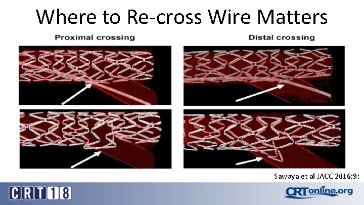 Where to Re-cross Wire Matters Sawaya et al JACC 2016; 9: 