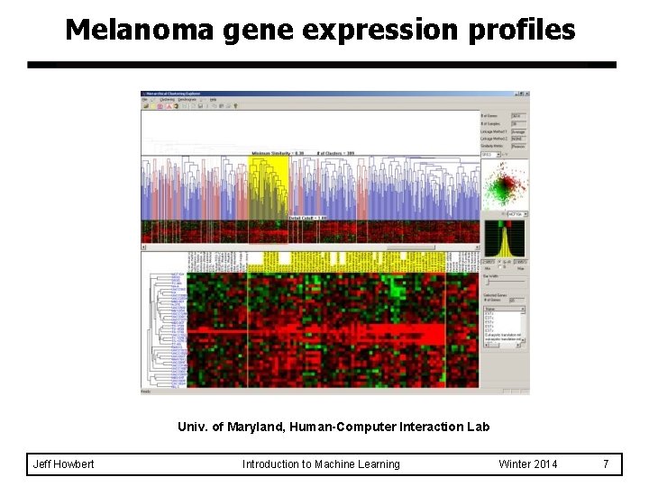 Melanoma gene expression profiles Univ. of Maryland, Human-Computer Interaction Lab Jeff Howbert Introduction to Melanoma gene expression profiles Univ. of Maryland, Human-Computer Interaction Lab Jeff Howbert Introduction to
