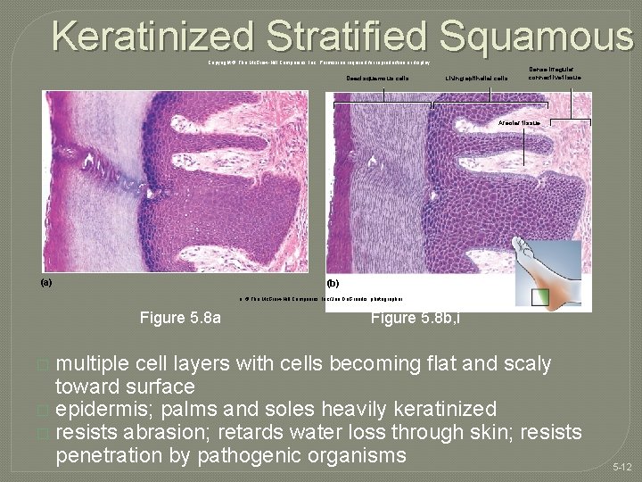 Keratinized Stratified Squamous Copyright © The Mc. Graw-Hill Companies, Inc. Permission required for reproduction