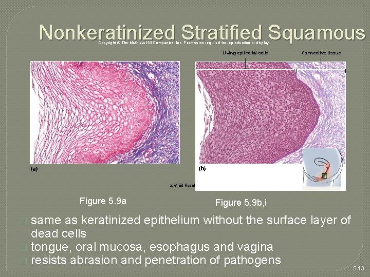 Nonkeratinized Stratified Squamous Copyright © The Mc. Graw-Hill Companies, Inc. Permission required for reproduction