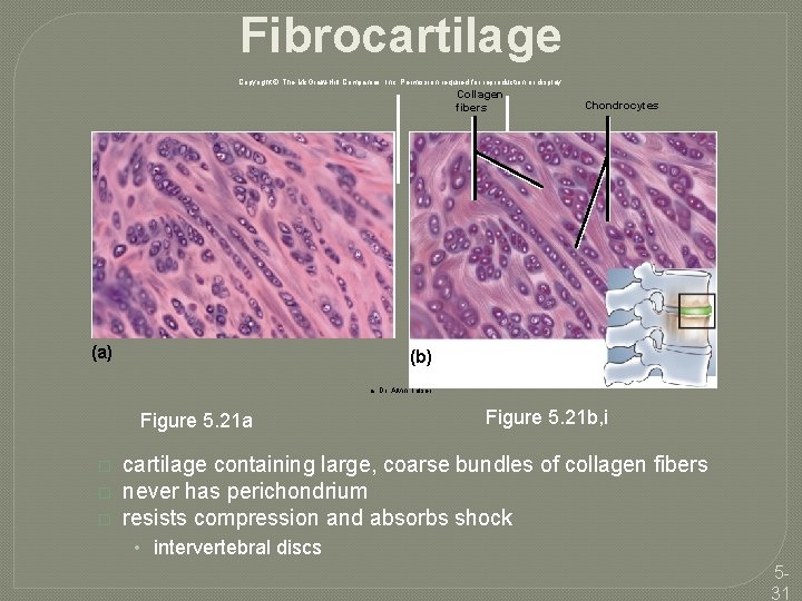 Fibrocartilage Copyright © The Mc. Graw-Hill Companies, Inc. Permission required for reproduction or display.