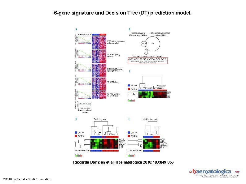 6 -gene signature and Decision Tree (DT) prediction model. Riccardo Bomben et al. Haematologica