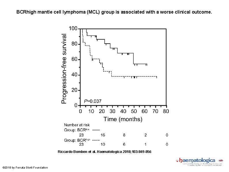 BCRhigh mantle cell lymphoma (MCL) group is associated with a worse clinical outcome. Riccardo