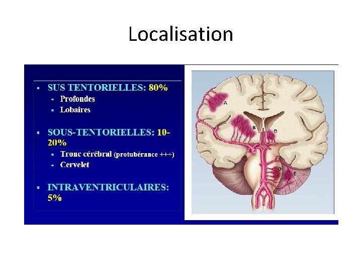 Localisation 