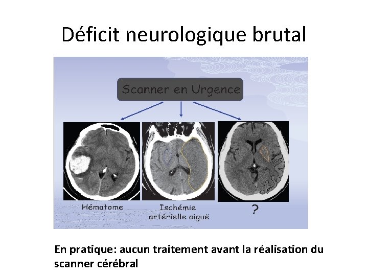 Déficit neurologique brutal En pratique: aucun traitement avant la réalisation du scanner cérébral 