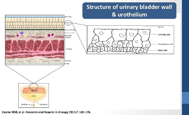 Structure of urinary bladder wall & urothelium Zacche MM, et al. Research and Reports